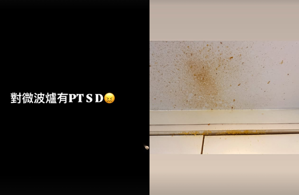 台灣地區藝人王晴有「八點檔林志玲」之稱，日前參考網路教學，用微波爐煮雞蛋，拿出時雞蛋爆炸，致使她眼角膜破裂、皮膚燙傷。（來源：serena_wang_qing@IG）