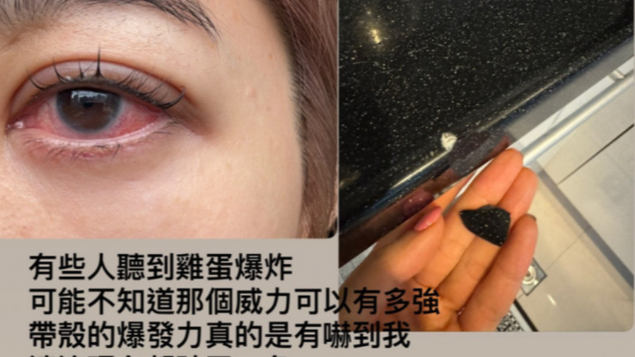 「八點檔林志玲」王晴微波爐煮蛋引爆炸，眼睛慘遭重創！的封面圖片